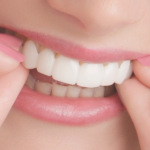 snap-on-smile-durabilidad-cuidados-dental